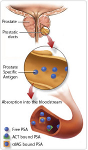 Prostate Cancer Screening