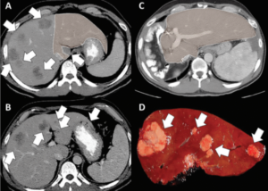 Figure 3, scans