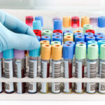 Is It Alzheimer’s Disease?