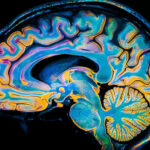 Identification and Validation of Biomarkers for Alzheimer’s Disease and Related Dementia Neuropsychological and biomechanical perspectives