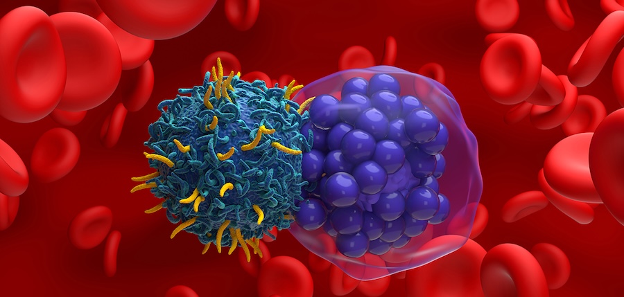 mantle cell lymphoma